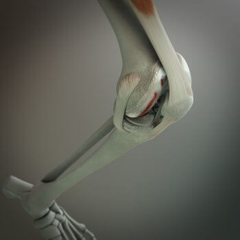 diseased_knee_rotm_nates diseased_knee_rotm_nates
