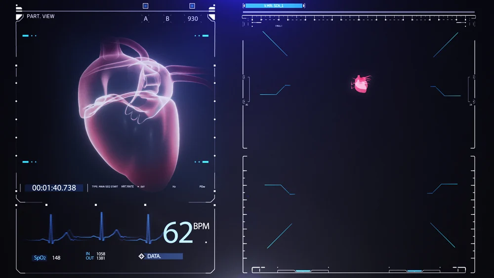 The 3D Medical Animation Process